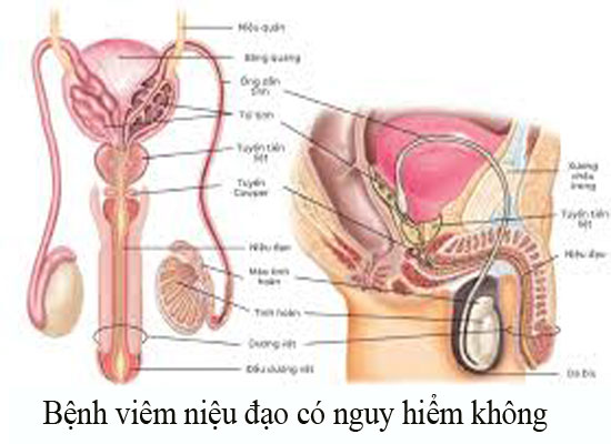 Bệnh viêm niệu đạo có nguy hiểm không