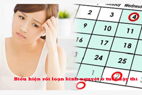 Rối loạn kinh nguyệt ở tuổi dậy thì nguyên nhân do đâu