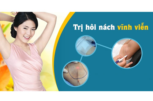 Cách chữa hôi nách triệt để