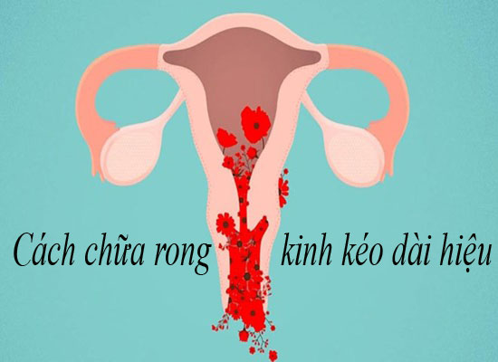 8 cách chữa rong kinh kéo dài hiệu quả