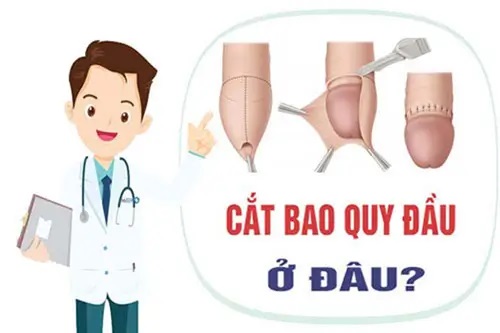Địa chỉ cắt bao quy đầu ở đâu tốt nhất tại Hà Nội
