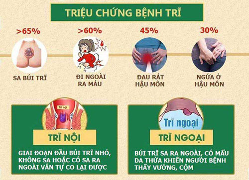 Dấu hiệu bệnh trĩ Dấu hiệu bệnh trĩ