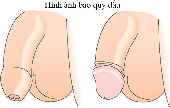 Hình ảnh bao quy đầu bình thường