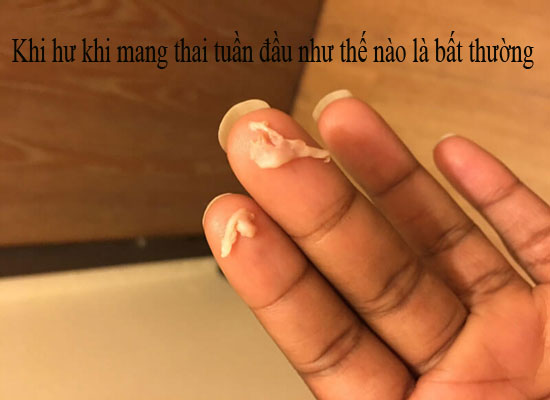 Khi hư khi mang thai tuần đầu như thế nào là bất thường