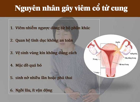 Nguyên nhân viêm cổ tử cung ở nữ giới