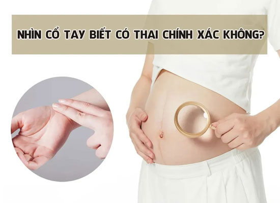 Cách nhìn cổ tay biết có thai tuần đầu