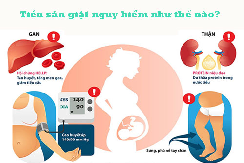 Tiền sản giật nguy hiểm như thế nào? Tiền sản giật nguy hiểm như thế nào?