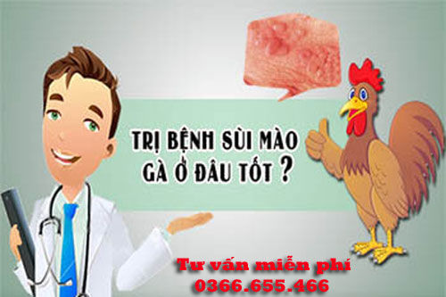 Địa chỉ khám chữa bệnh sùi mào gà ở đâu tốt nhất Hà Nội