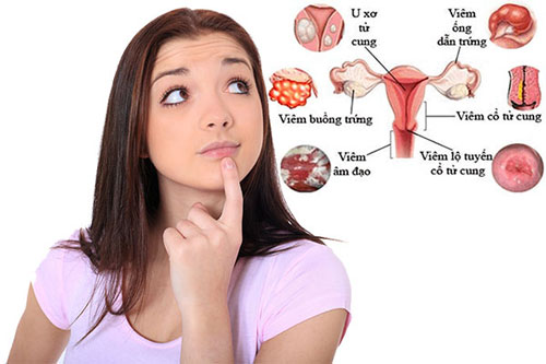 Các bệnh phụ khoa thường gặp ở phụ nữ hiện nay