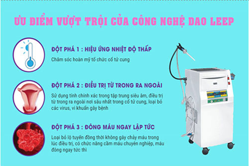 Cách chữa viêm lộ tuyến cổ tử cung Cách chữa viêm lộ tuyến cổ tử cung
