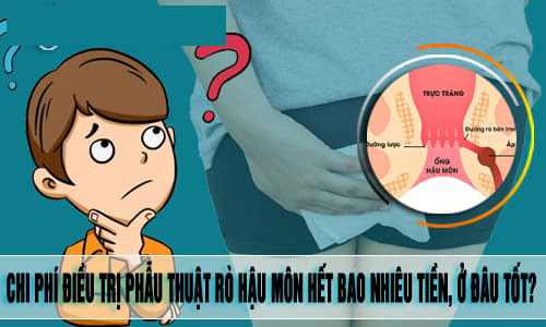 Chi phí phẫu thuật rò hậu môn hết bao nhiêu tiền?