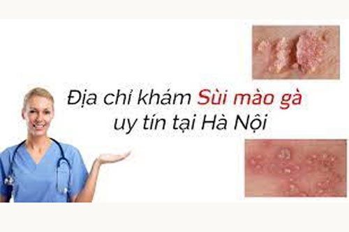 11 Địa chỉ khám chữa bệnh sùi mào gà ở đâu tốt nhất Hà Nội
