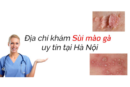 Khám chữa sùi mào gà ở đâu tốt Khám chữa sùi mào gà ở đâu tốt