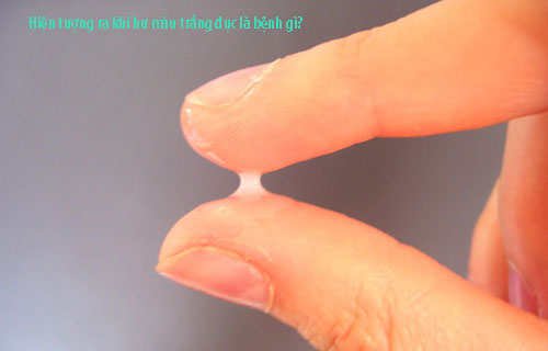 Hiện tượng ra khí hư màu trắng đục là bệnh gì? Hiện tượng ra khí hư màu trắng đục là bệnh gì?