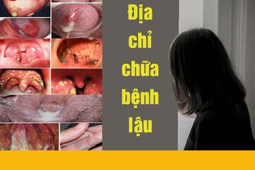 Khám chữa bệnh lậu ở Bệnh viện E