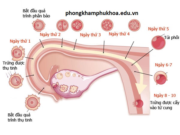 Mang thai ngoài tử cung là gì?