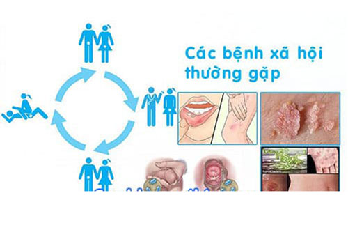 Một số thông tin tổng quan về bệnh xã hội