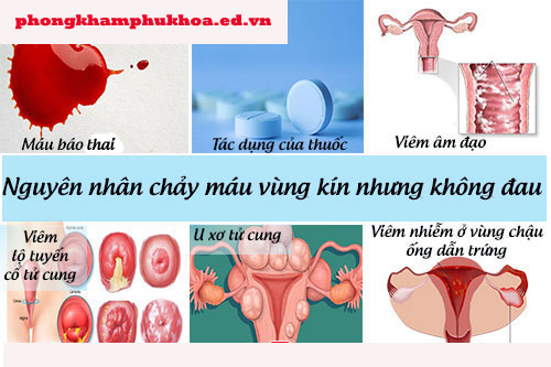 Nguyên nhân chảy máu vùng kín nhưng không đau Nguyên nhân chảy máu vùng kín nhưng không đau