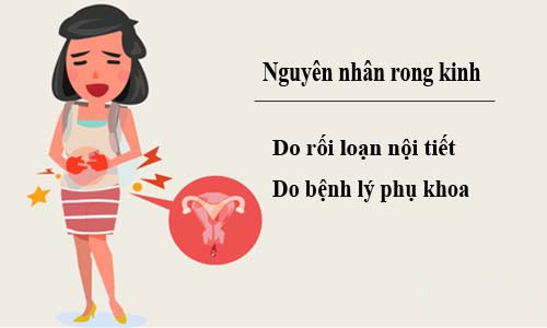 Nguyên nhân gây rong kinh Nguyên nhân gây rong kinh