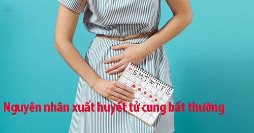 Nguyên nhân xuất huyết tử cung bất thường Nguyên nhân xuất huyết tử cung bất thường