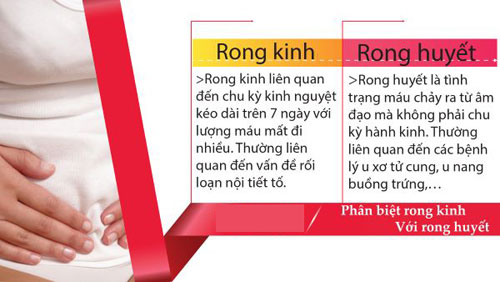 Rong kinh là gì? Dấu hiệu triệu chứng, nguyên nhân và cách chữa