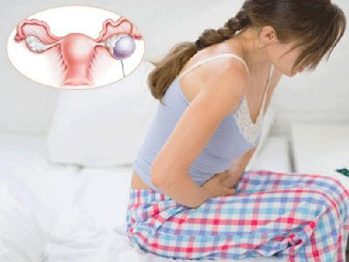 Suy buồng trứng: dấu hiệu, triệu chứng, nguyên nhân và cách điều trị