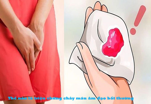Chảy máu âm đạo: nguyên nhân, triệu chứng, cách chữa