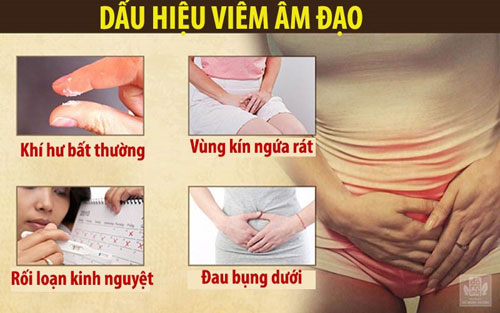 Triệu chứng viêm âm đạo Triệu chứng viêm âm đạo