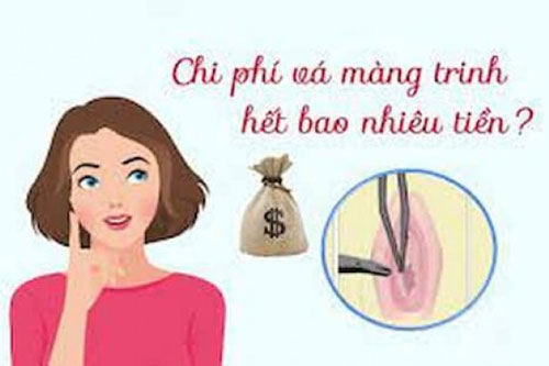 Vá màng trinh hết bao nhiêu tiền? Top 7 địa chỉ uy tín tại Hà Nội