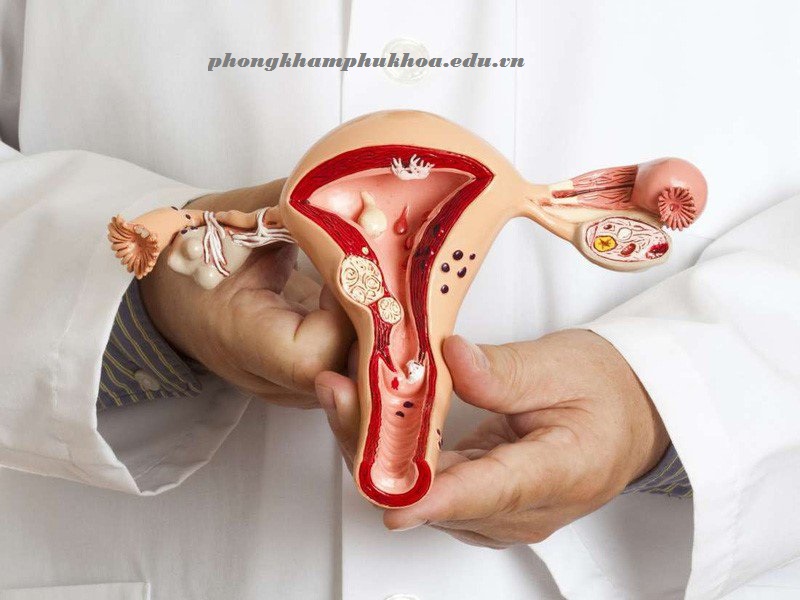 Nguy cơ mắc ung thư cổ tử cung khi có 3 dấu hiệu này trong kỳ kinh nguyệt