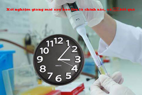 Xét nghiệm giang mai sau bao lâu là chính xác, có kết quả? Xét nghiệm giang mai sau bao lâu là chính xác, có kết quả?